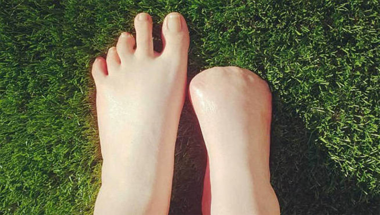 ¡Tenga Cuidado!, Mujer Pierde dedos del Pie por Pedicure con Peces