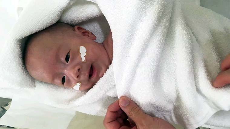 Bebe Prematuro de 268 gramos de Peso Sobrevive